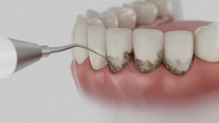 Trusted Tooth Extraction service in Watauga, TX - Dentist Open Now